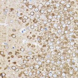 Invitrogen ROCK2 Polyclonal Antibody 100 &mu;L; Unconjugated:Antibodies,