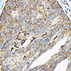 Invitrogen ROCK2 Polyclonal Antibody 100 &mu;L; Unconjugated:Antibodies,