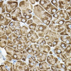 Invitrogen ROCK2 Polyclonal Antibody 100 &mu;L; Unconjugated:Antibodies,