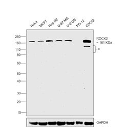 Invitrogen ROCK2 Polyclonal Antibody 100 &mu;L; Unconjugated:Antibodies,