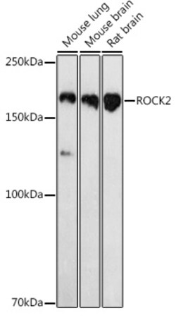 Invitrogen ROCK2 Polyclonal Antibody 100 &mu;L; Unconjugated:Antibodies,