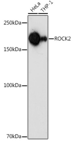 Invitrogen ROCK2 Polyclonal Antibody 100 &mu;L; Unconjugated:Antibodies,