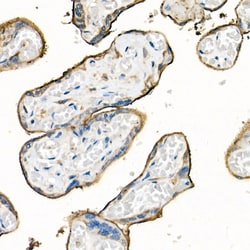 Invitrogen CD98 Polyclonal Antibody 100 &mu;L; Unconjugated:Antibodies,