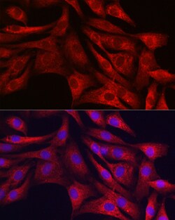 Invitrogen SIRT3 Polyclonal Antibody 100 &mu;L; Unconjugated:Antibodies,