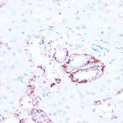 Invitrogen SIRT3 Polyclonal Antibody 100 &mu;L; Unconjugated:Antibodies,
