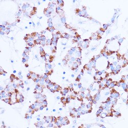 Invitrogen SIRT3 Polyclonal Antibody 100 &mu;L; Unconjugated:Antibodies,