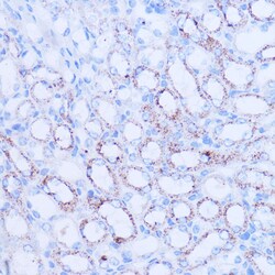 Invitrogen SIRT3 Polyclonal Antibody 100 &mu;L; Unconjugated:Antibodies,