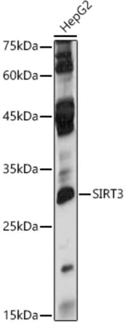 Invitrogen SIRT3 Polyclonal Antibody 100 &mu;L; Unconjugated:Antibodies,
