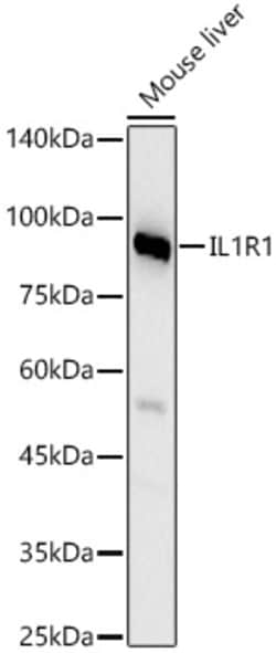 Invitrogen IL1R1 Polyclonal Antibody 100 &mu;L | Buy Online | Invitrogen&trade; | Fisher Scientific