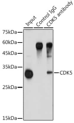 Invitrogen CDK5 Polyclonal Antibody 100 &mu;L; Unconjugated:Antibodies,