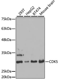 Invitrogen CDK5 Polyclonal Antibody 100 &mu;L; Unconjugated:Antibodies,