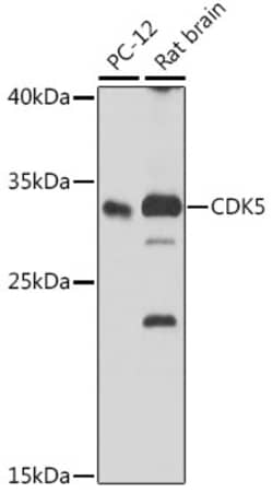 Invitrogen CDK5 Polyclonal Antibody 100 &mu;L; Unconjugated:Antibodies,