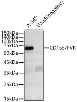Invitrogen CD155 Polyclonal Antibody 100 &mu;L; Unconjugated:Antibodies,