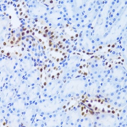 Invitrogen PHAP I Polyclonal Antibody 100 &mu;L; Unconjugated:Antibodies,