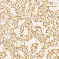 ATP Synthase beta Polyclonal Antibody:Antibodies, Polyclonal