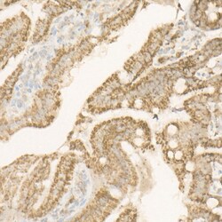 ATP Synthase beta Polyclonal Antibody:Antibodies, Polyclonal