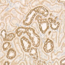 ATP Synthase beta Polyclonal Antibody:Antibodies, Polyclonal