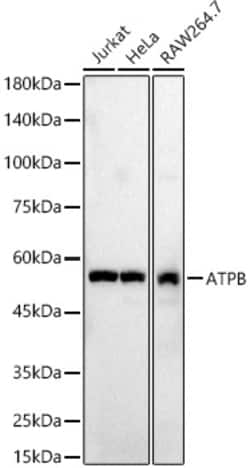 ATP Synthase beta Polyclonal Antibody:Antibodies, Polyclonal