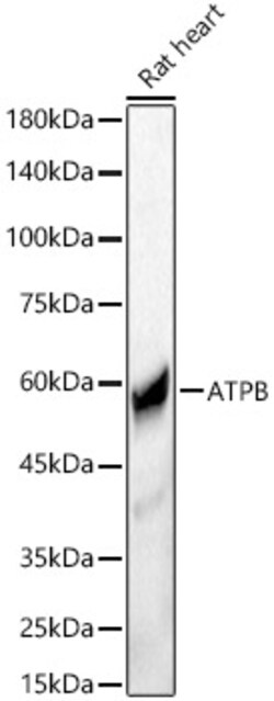 ATP Synthase beta Polyclonal Antibody:Antibodies, Polyclonal