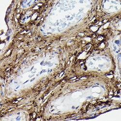 Invitrogen COL1A2 Polyclonal Antibody 100 &mu;L; Unconjugated:Antibodies,