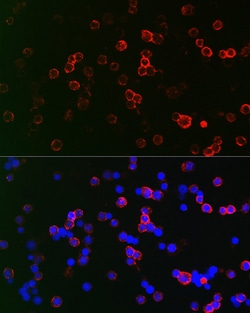 Invitrogen CD22 Polyclonal Antibody 100 &mu;L; Unconjugated:Antibodies,