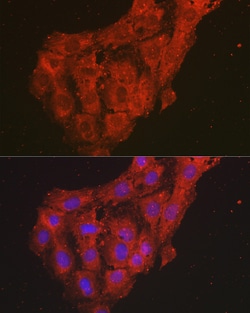 Invitrogen CXCL1 Polyclonal Antibody 100 &mu;L; Unconjugated:Antibodies,
