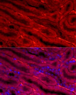 Invitrogen BBOX1 Polyclonal Antibody 100 &mu;L; Unconjugated:Antibodies,