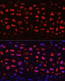 COMP Polyclonal Antibody:Antibodies, Polyclonal