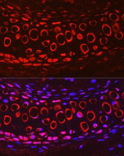 COMP Polyclonal Antibody:Antibodies, Polyclonal