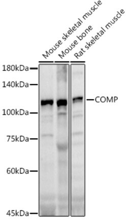 COMP Polyclonal Antibody:Antibodies, Polyclonal