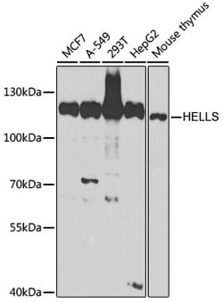 Invitrogen HELLS Polyclonal Antibody 100 &mu;L | Buy Online | Invitrogen&trade; | Fisher Scientific