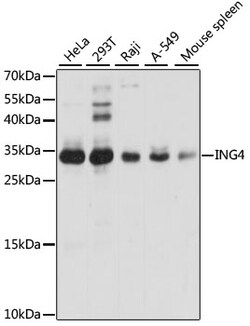 Invitrogen ING4 Polyclonal Antibody 100 &mu;L; Unconjugated:Antibodies,