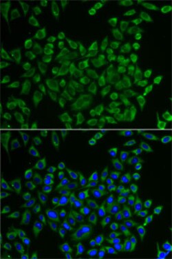 Invitrogen MRPS30 Polyclonal Antibody 100 &mu;L; Unconjugated:Antibodies,