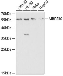 Invitrogen MRPS30 Polyclonal Antibody 100 &mu;L; Unconjugated:Antibodies,
