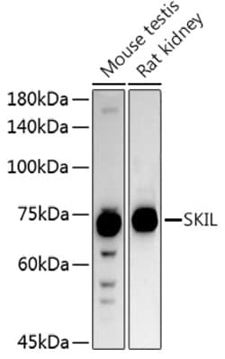 Invitrogen SnoN Polyclonal Antibody 100 &mu;L | Buy Online | Invitrogen&trade; | Fisher Scientific