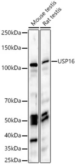 Invitrogen USP16 Polyclonal Antibody 100 &mu;L; Unconjugated:Antibodies,