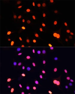 Invitrogen Di-Methyl-Lysine Polyclonal Antibody 100 &mu;L; Unconjugated:Antibodies,