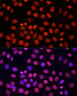 Invitrogen Di-Methyl-Lysine Polyclonal Antibody 100 &mu;L; Unconjugated:Antibodies,