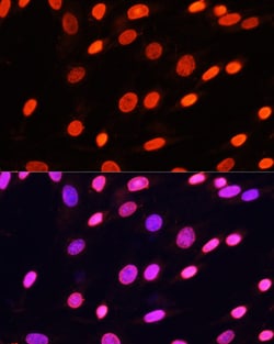 Invitrogen Di-Methyl-Lysine Polyclonal Antibody 100 &mu;L; Unconjugated:Antibodies,