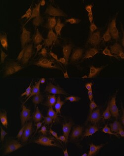 Invitrogen SND1 Polyclonal Antibody 100 &mu;L; Unconjugated:Antibodies,