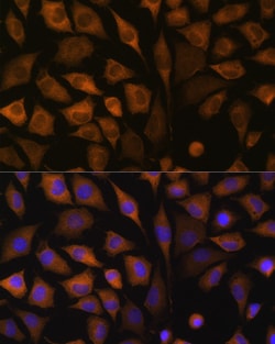 Invitrogen SND1 Polyclonal Antibody 100 &mu;L; Unconjugated:Antibodies,