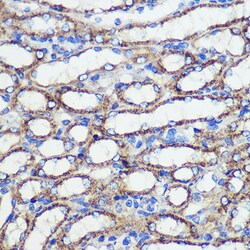 Invitrogen SND1 Polyclonal Antibody 100 &mu;L; Unconjugated:Antibodies,