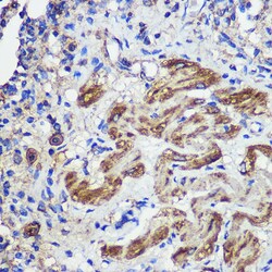 Invitrogen SND1 Polyclonal Antibody 100 &mu;L; Unconjugated:Antibodies,