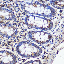Invitrogen SND1 Polyclonal Antibody 100 &mu;L; Unconjugated:Antibodies,
