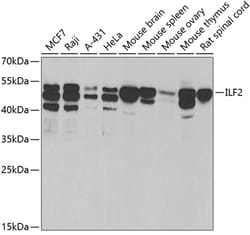 Invitrogen ILF2 Polyclonal Antibody 100 &mu;L; Unconjugated:Antibodies,