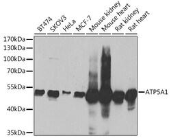 Invitrogen ATP5A1 Polyclonal Antibody 100 &mu;L; Unconjugated:Antibodies,