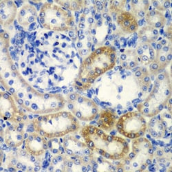Invitrogen DCTD Polyclonal Antibody 100 &mu;L; Unconjugated:Antibodies,