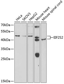 Invitrogen eIF2 beta Polyclonal Antibody 100 &mu;L; Unconjugated:Antibodies,