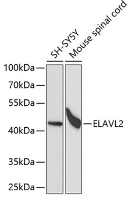 Invitrogen ELAVL2 Polyclonal Antibody 100 &mu;L; Unconjugated:Antibodies,
