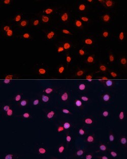 Invitrogen FUS Polyclonal Antibody 100 &mu;L | Buy Online | Invitrogen&trade; | Fisher Scientific